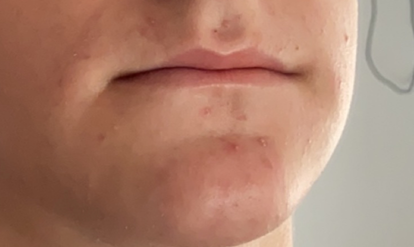 IMG 0955
