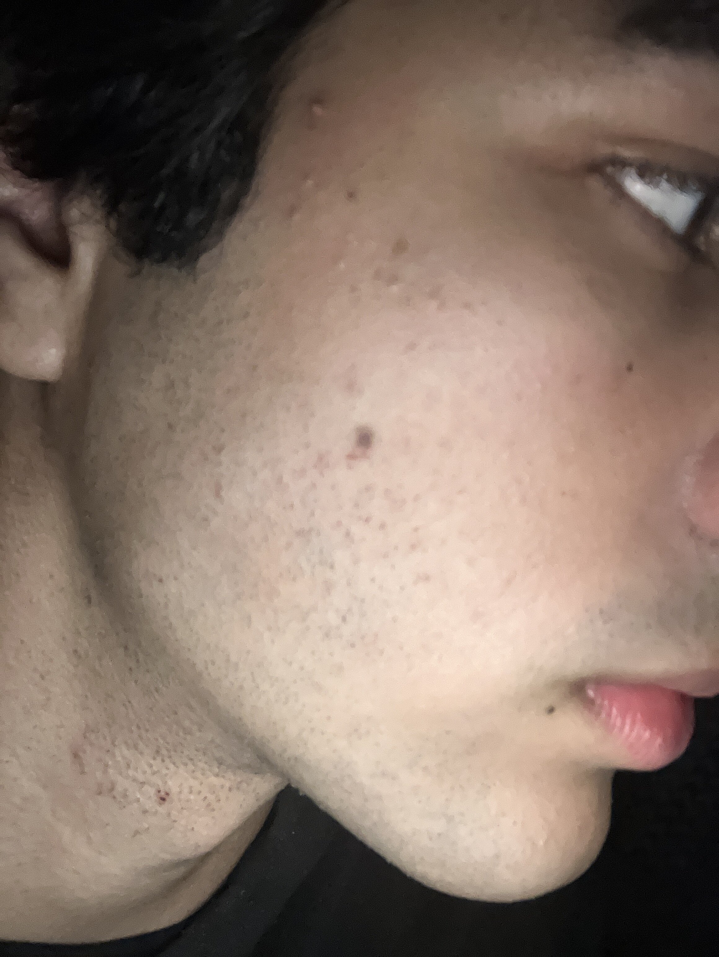 B7DD04DD 24E1 461C A18C 19574C6CEF61