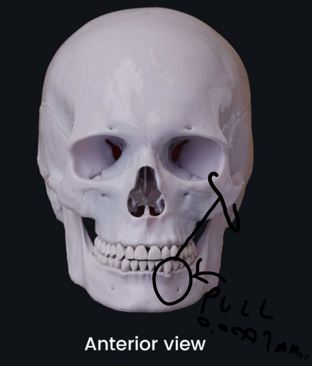 1000042966