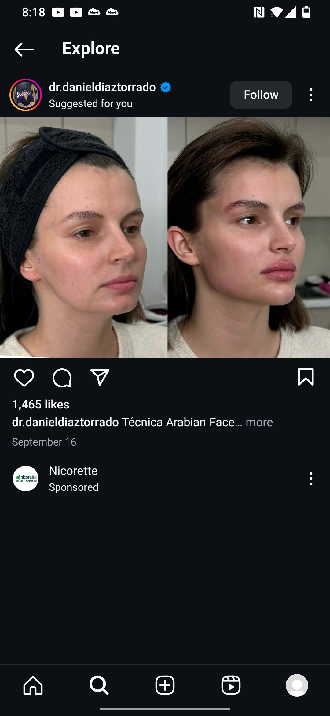 Screenshot 20241123 081814