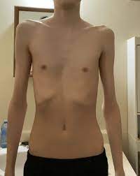 Images 1