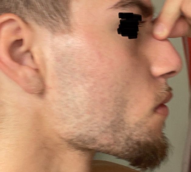 IMG 2812