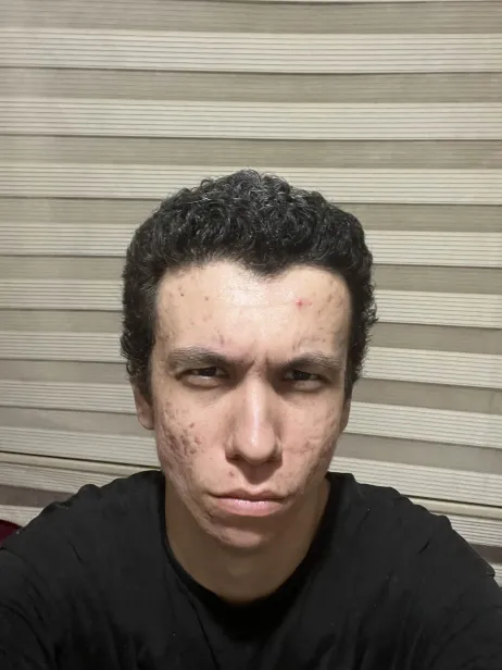 4607091 4606500 4395412 IMG 0095