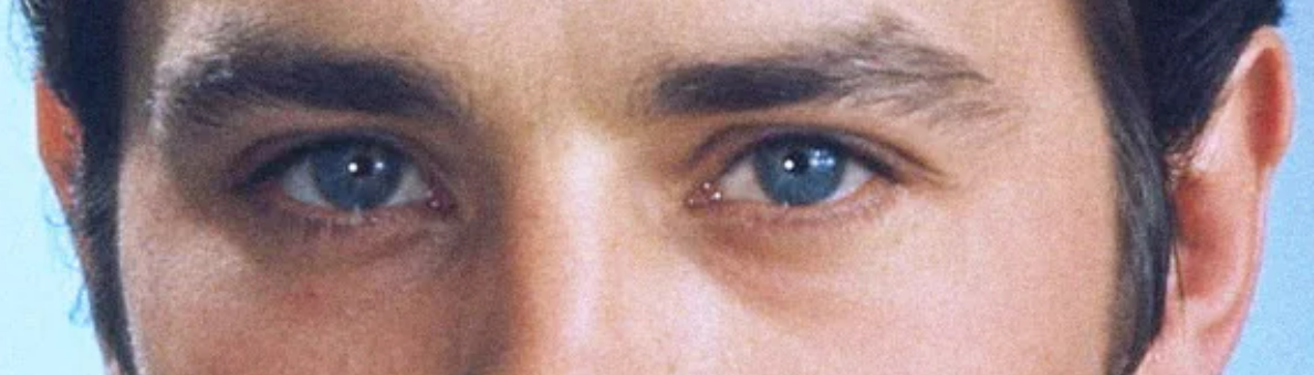 Eye2