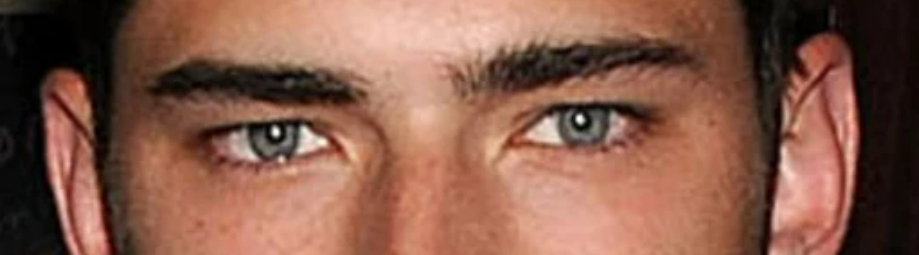Eye1