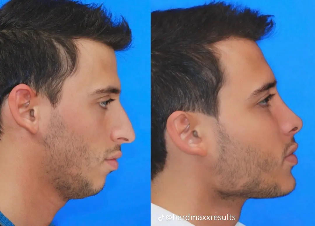 Temp image 7457C060 CD61 4E5D A27E 3FAF9A487081