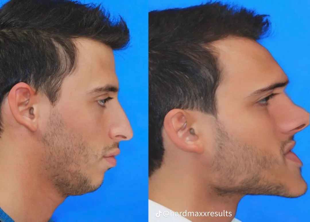 328ADA7F 0286 4697 A471 A63A771E2E3C