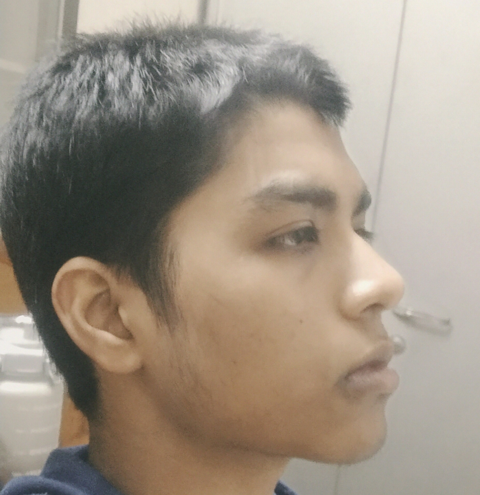 1000203618