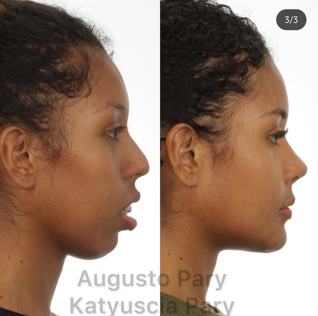 Screenshot 20250202 234328 Instagram