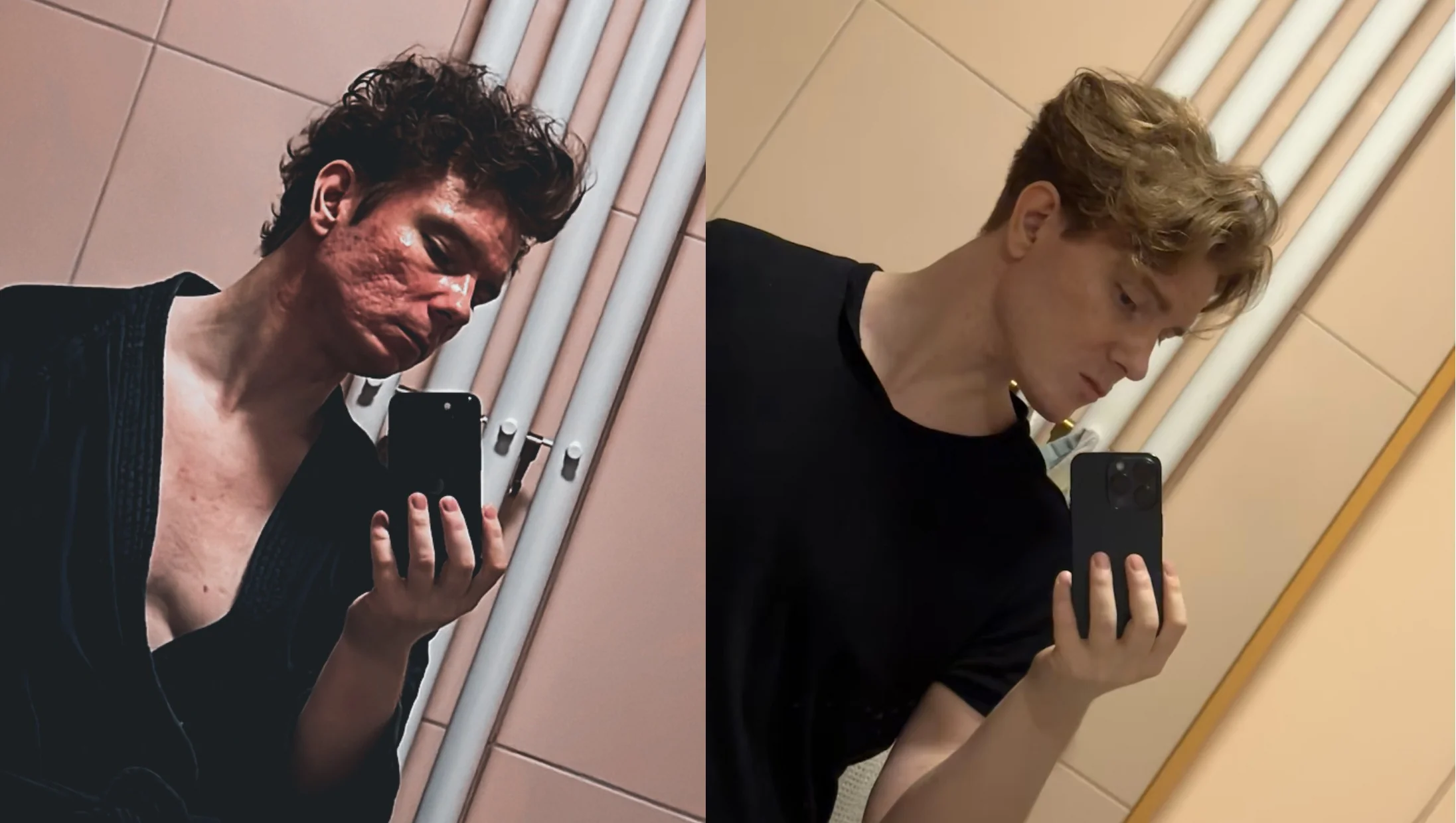 7 months post op before and after scans face all credits to v0 zke64piqvrde1