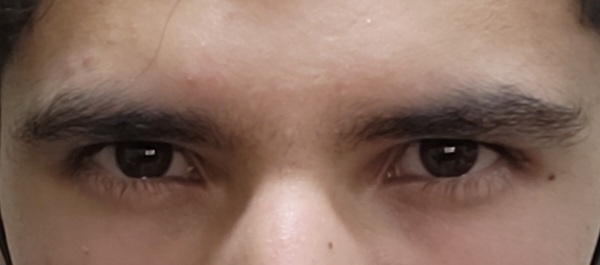 1000011641