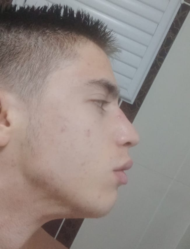 1000095068