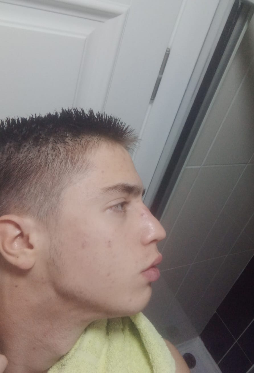 1000095072
