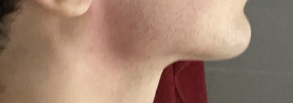 IMG 0751