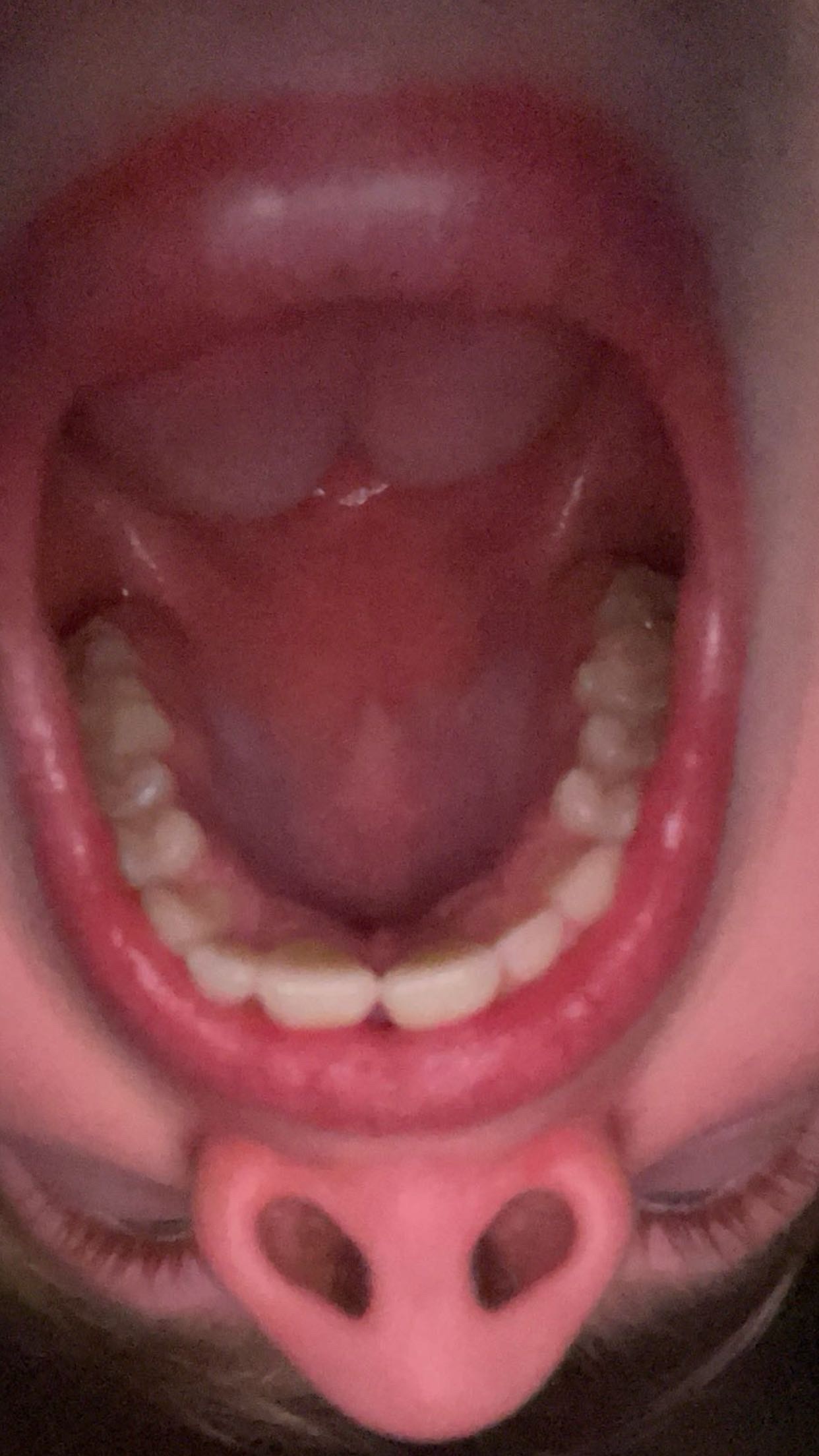 IMG 1494