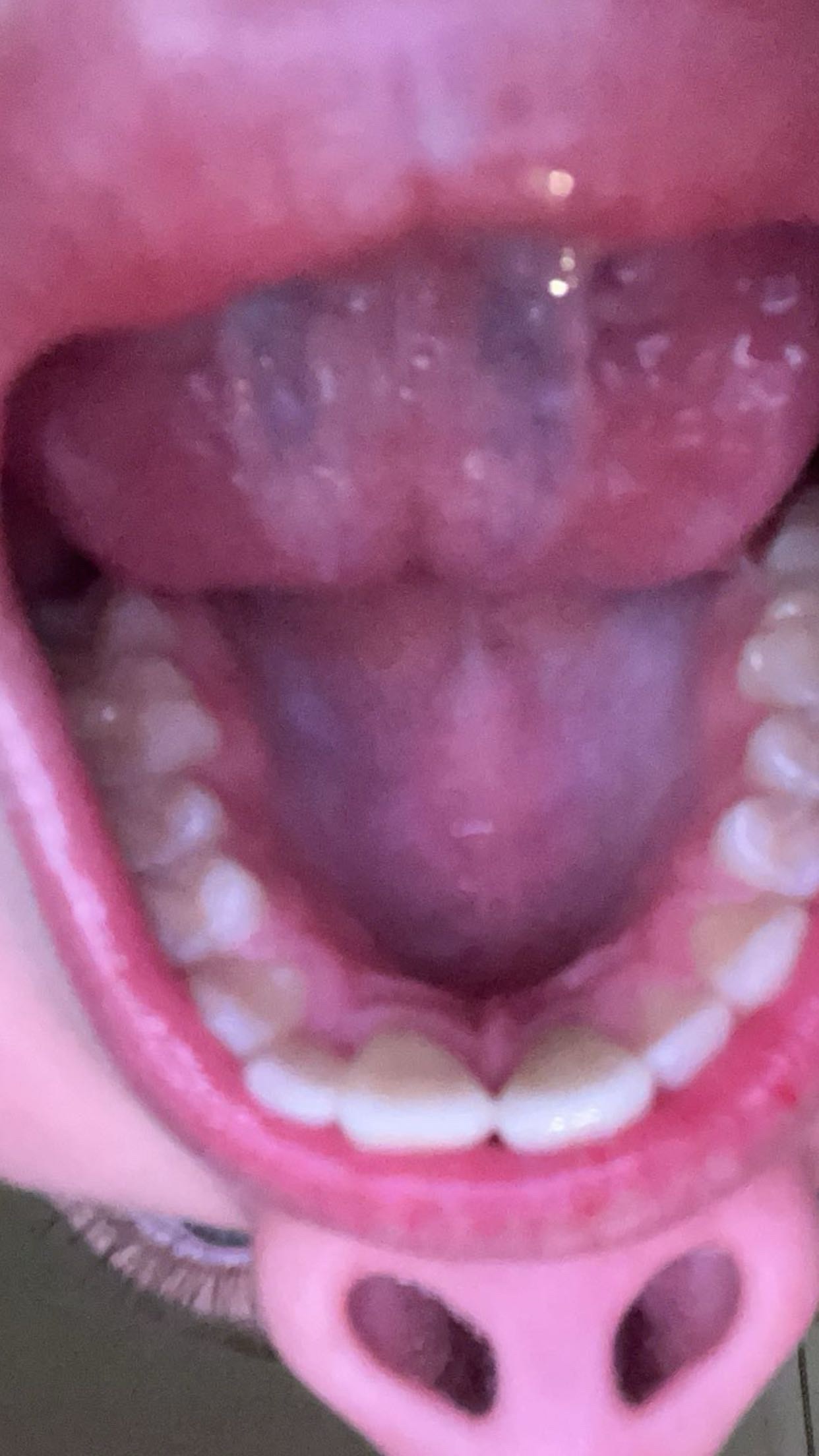 IMG 1493