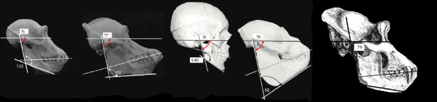 The angle in degrees between the posterior margin of the mandibular ramus and the