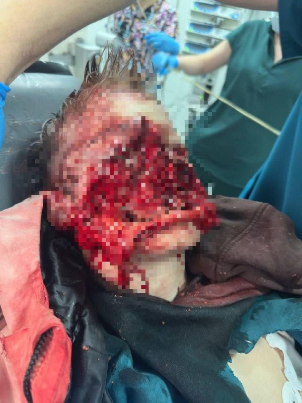 96eeac98 09d1 40b3 81fd 9b09cd9ea3c5