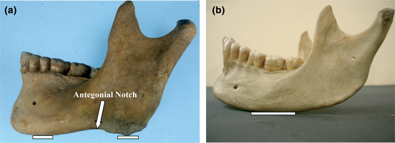 Ar24566 fig 0001 m