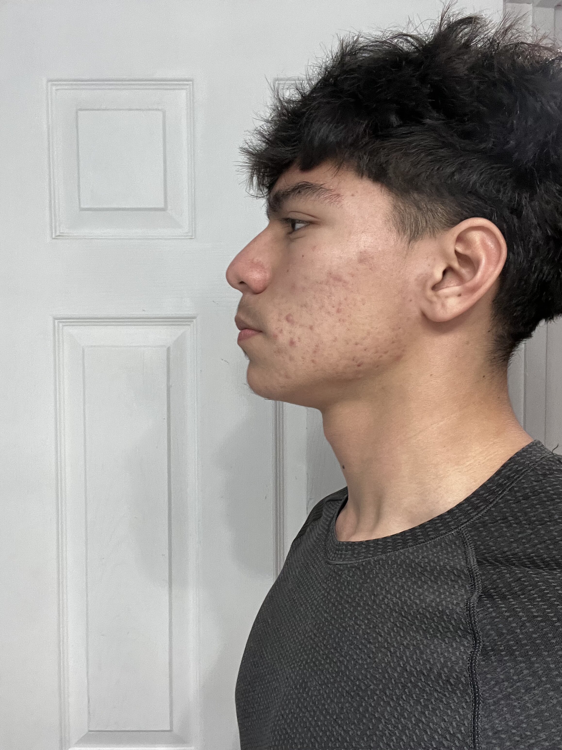 IMG 0131