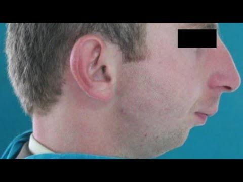 Images 3