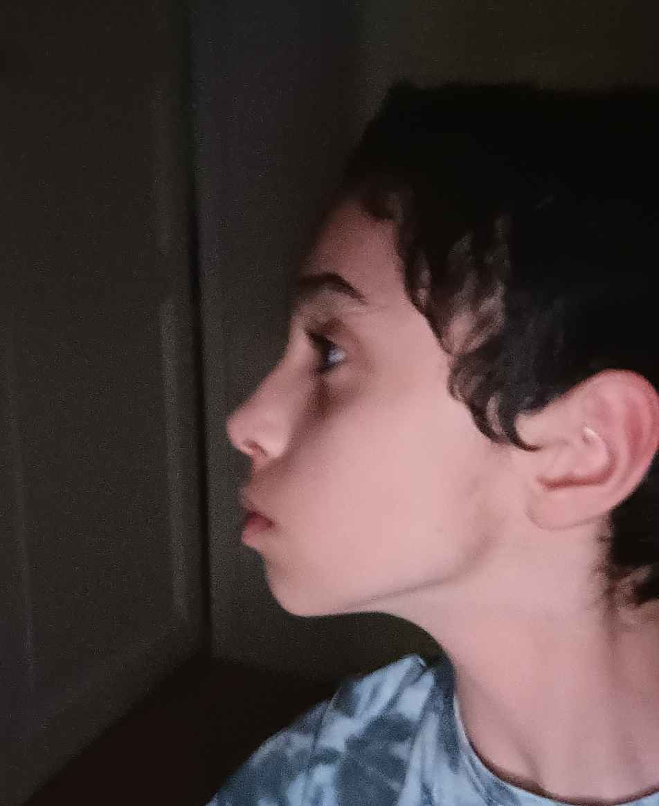 Screenshot 2025 03 04 14 41 28 054 comsnapchatandroid edit