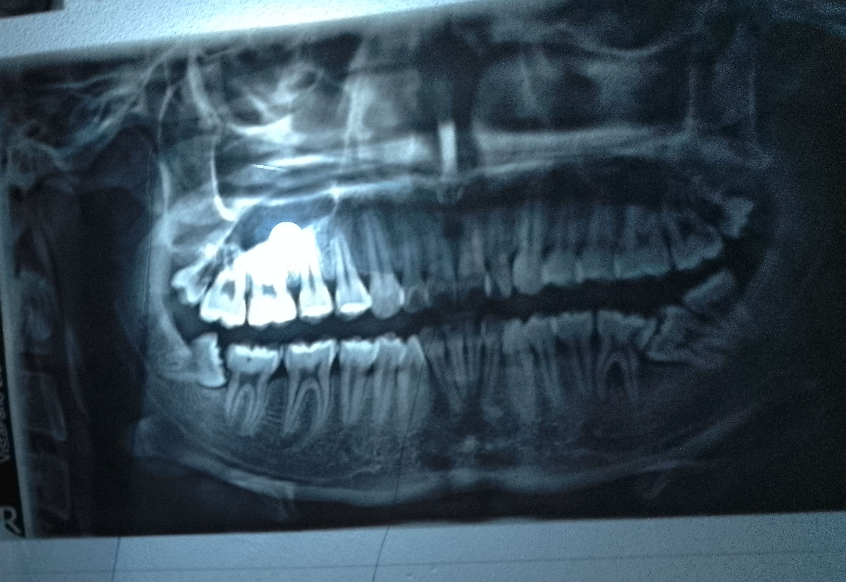 IMG 20250302 0829442
