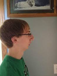 IMG 1601