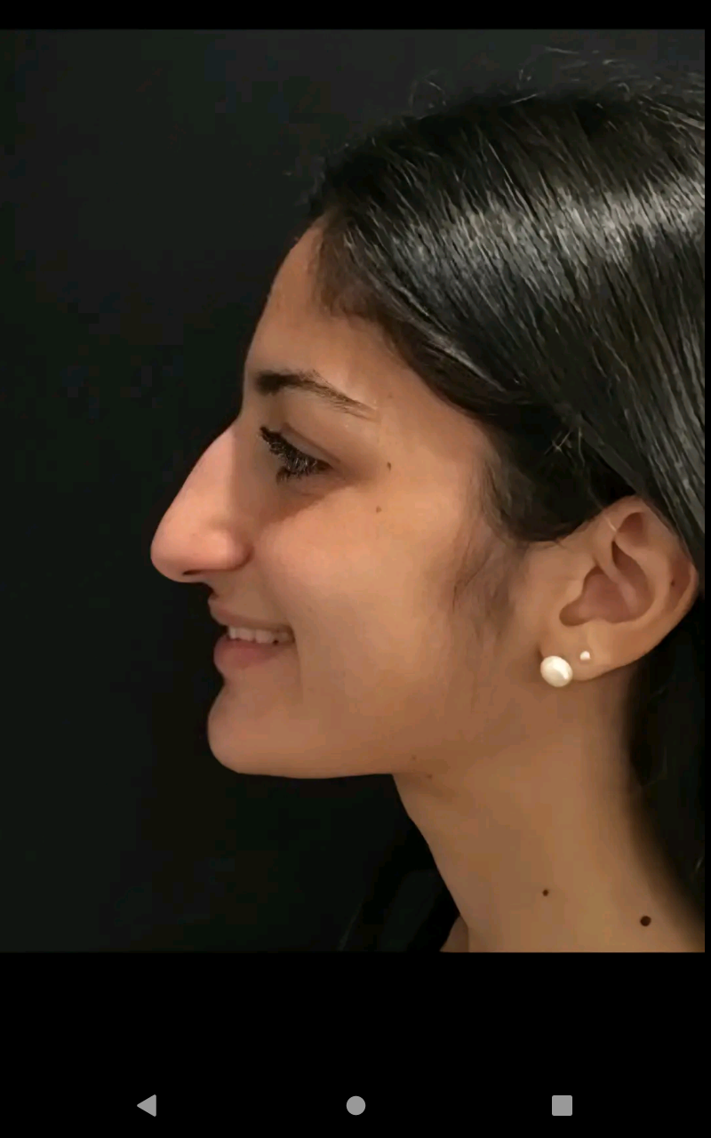 Screenshot 20250313 174314