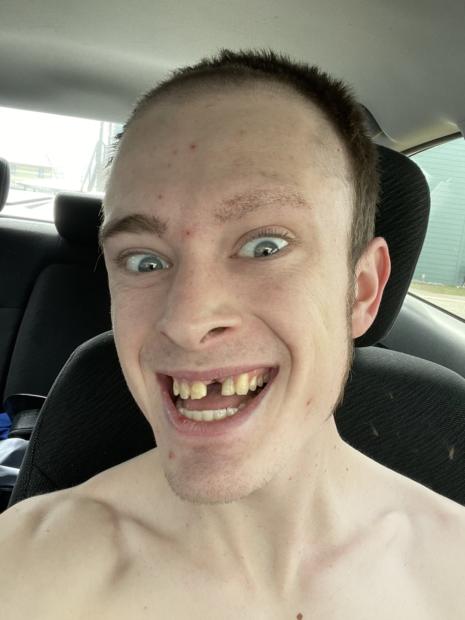 GiPFvBQXAAEK4zN
