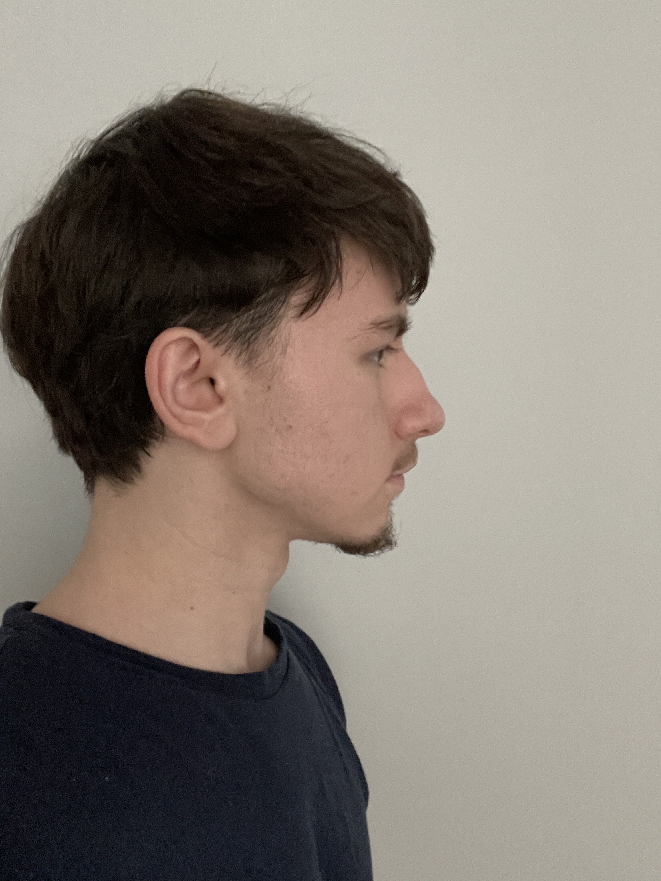IMG 0030