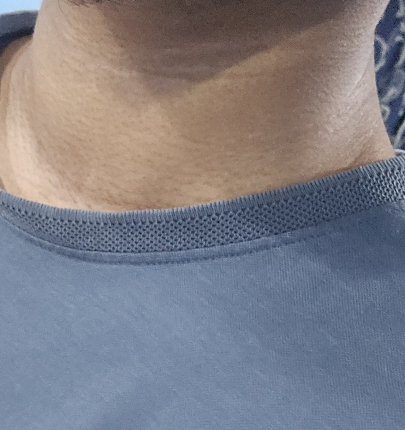 1000035217 1000035217