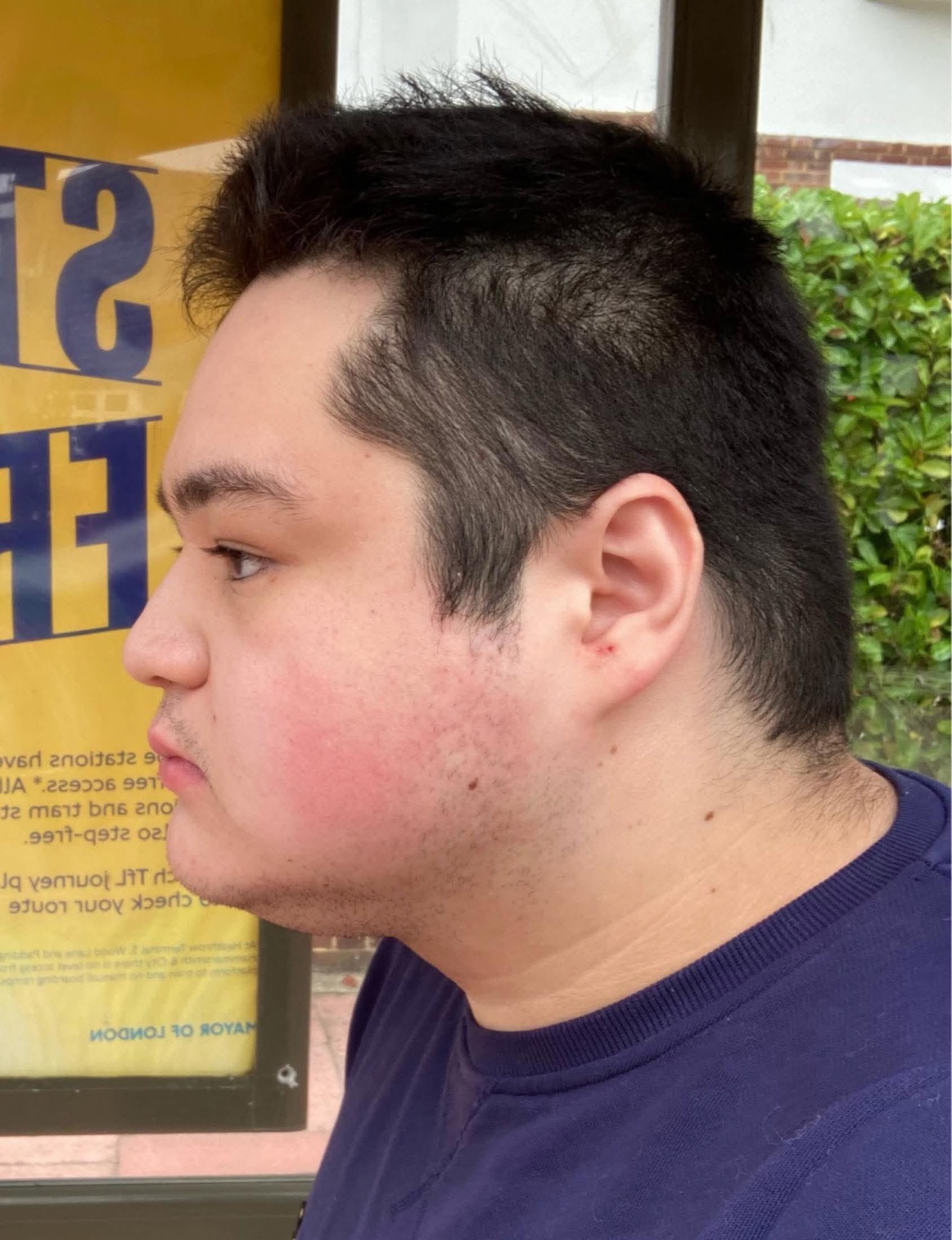 A93cda0d3fec734d4b27b4a3d07c2678