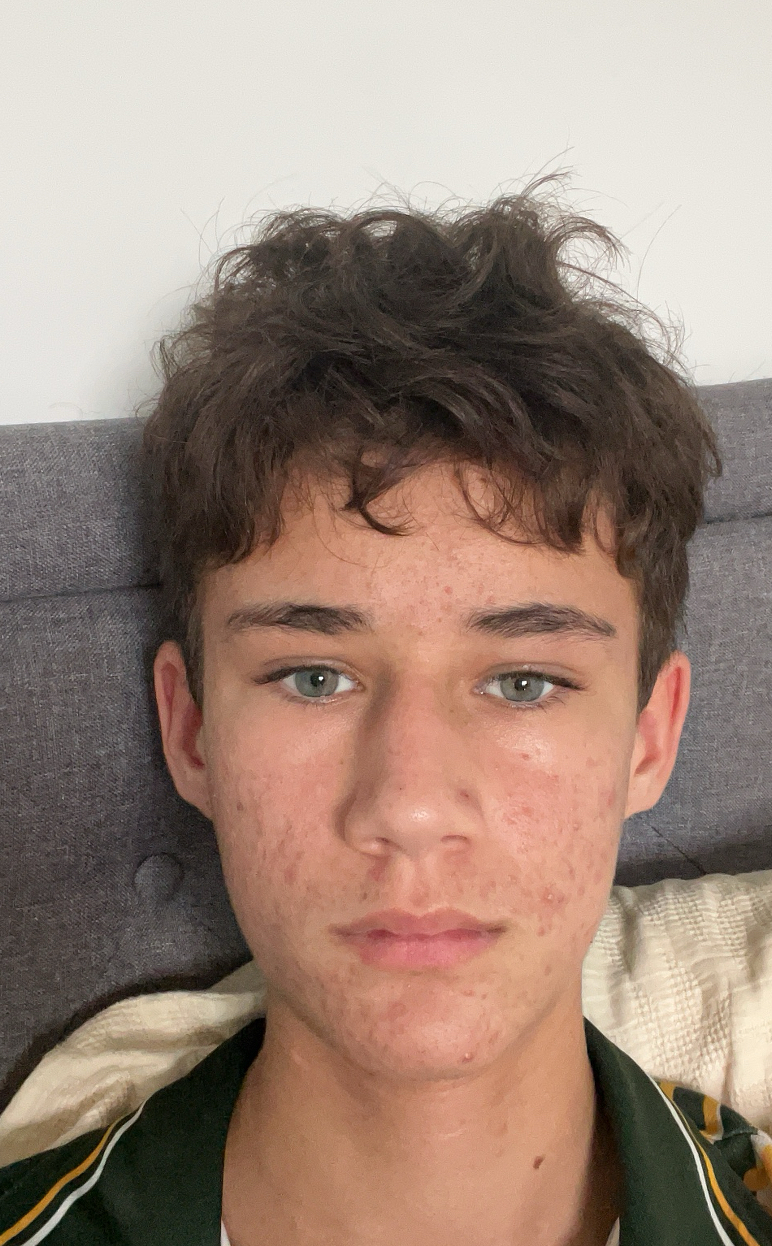 IMG 1876