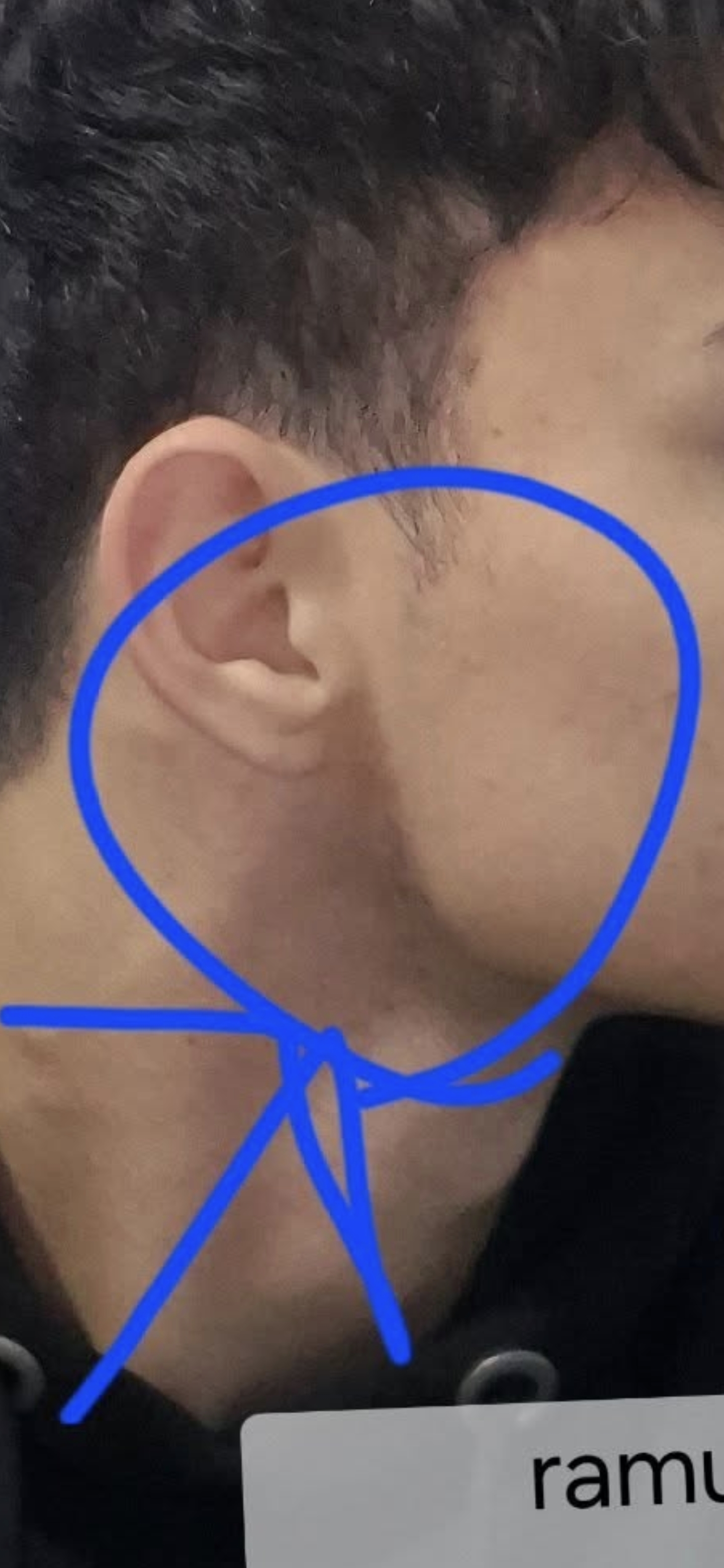 1000076103