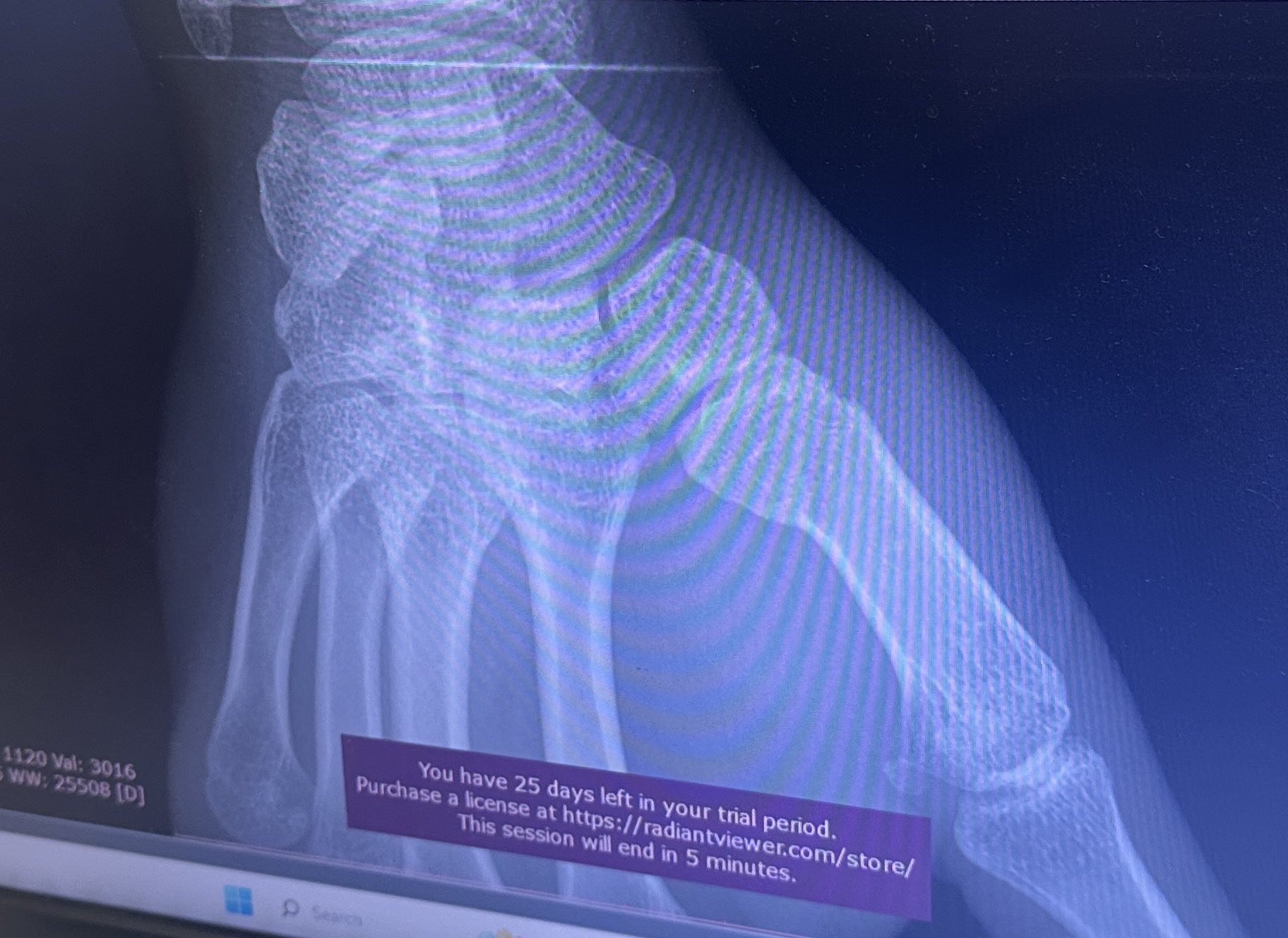 Xray2