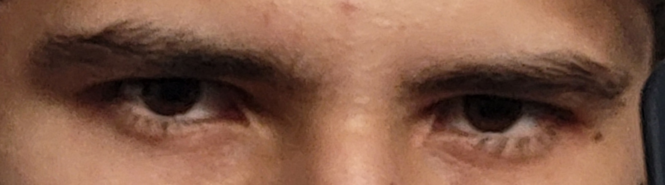 1000031438