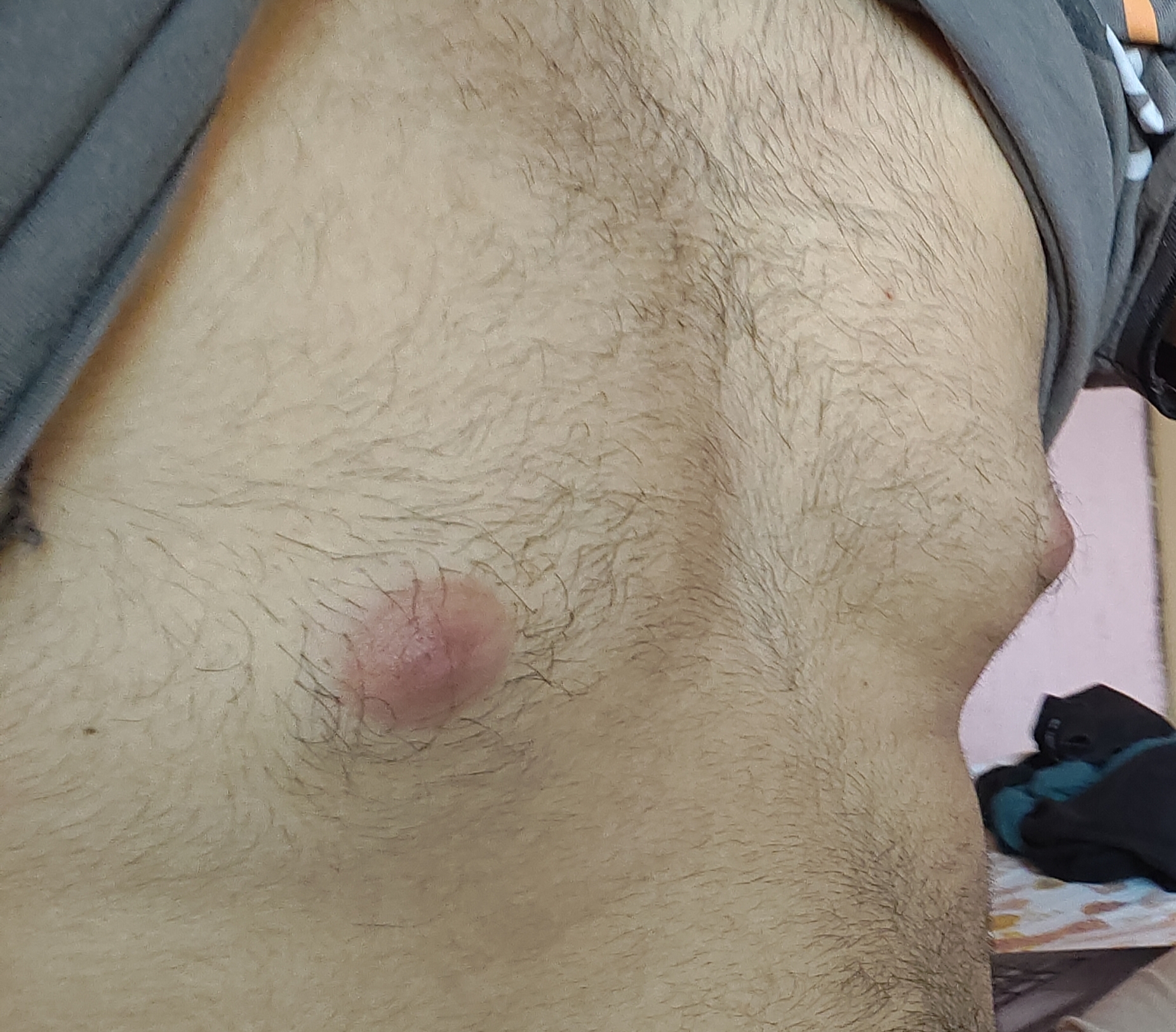1000027706