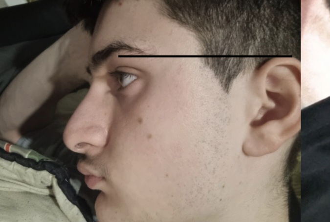 1000020261