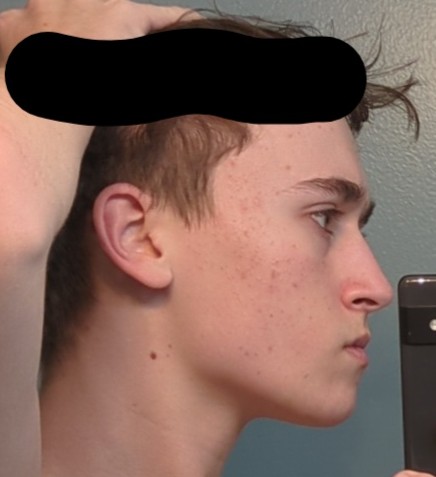 1000002575