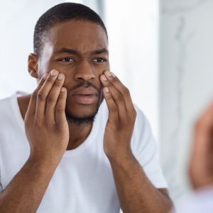 Conditions dull skin skn clinics