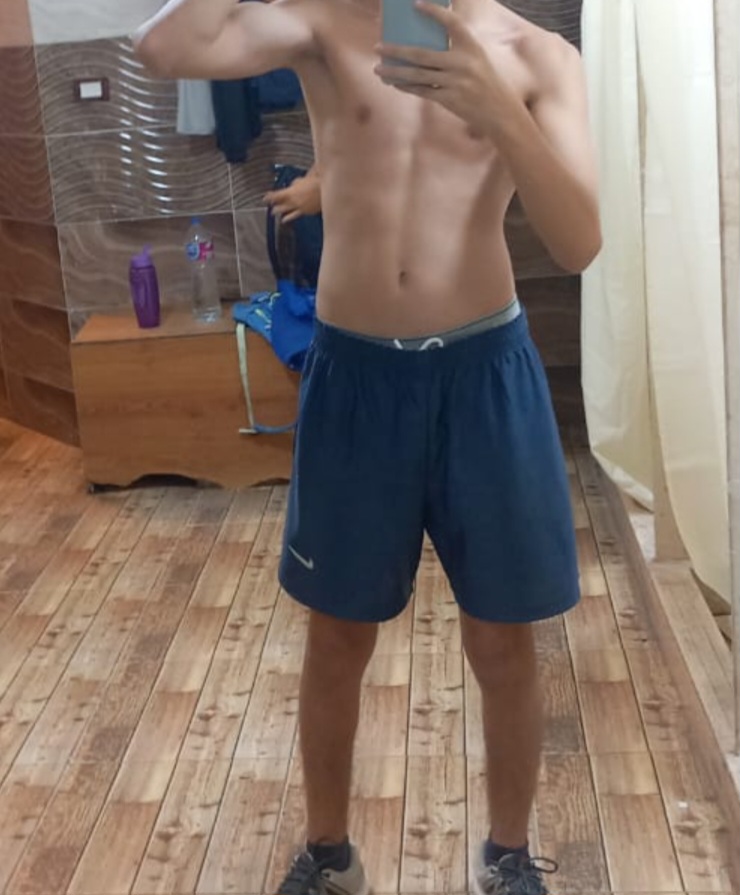 1000436721