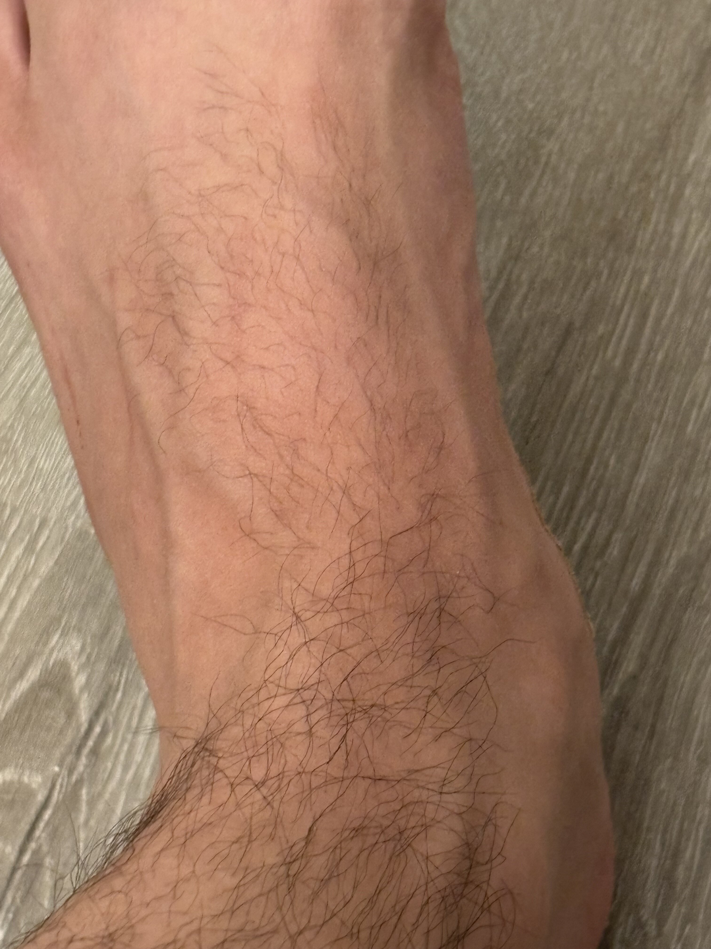 IMG 1479