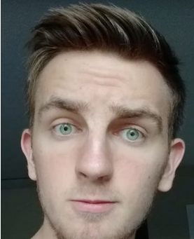 Screenshot 2025-04-26 at 02-11-35 before steroids vs after face - Google Suche.png