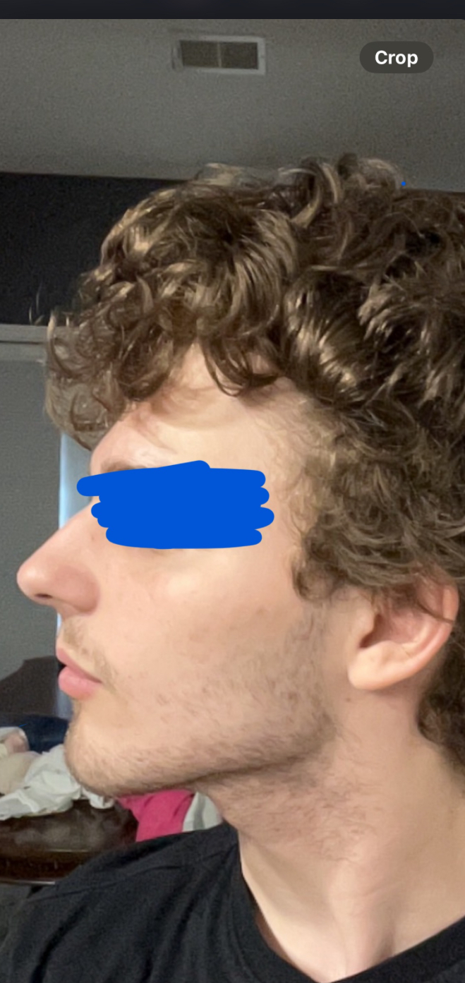 IMG 1972