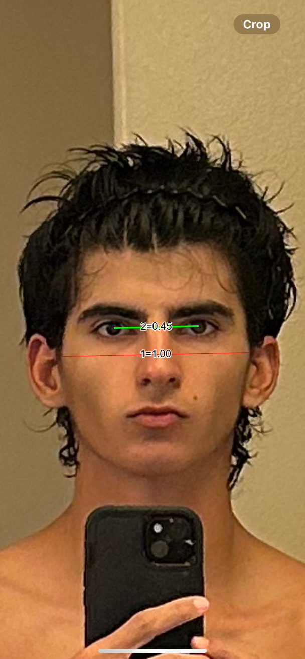 Esr