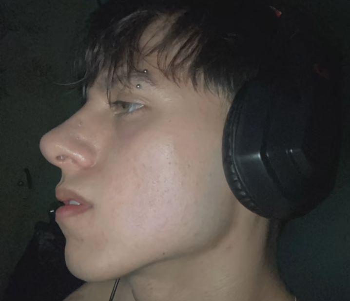 YO1