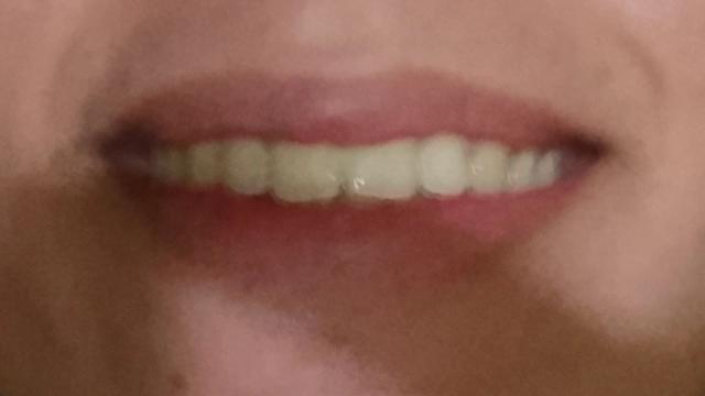 Teeths