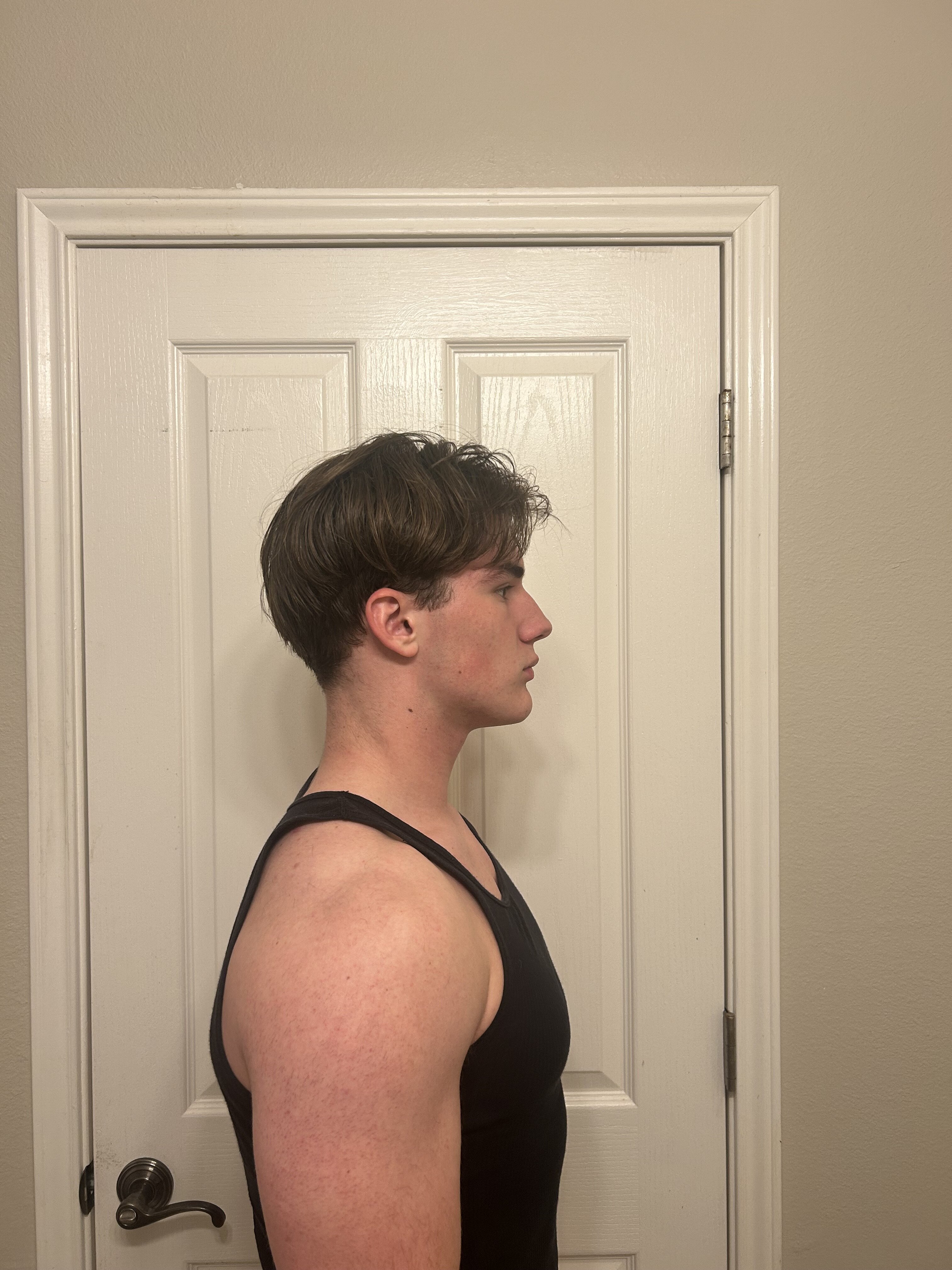 IMG 4625