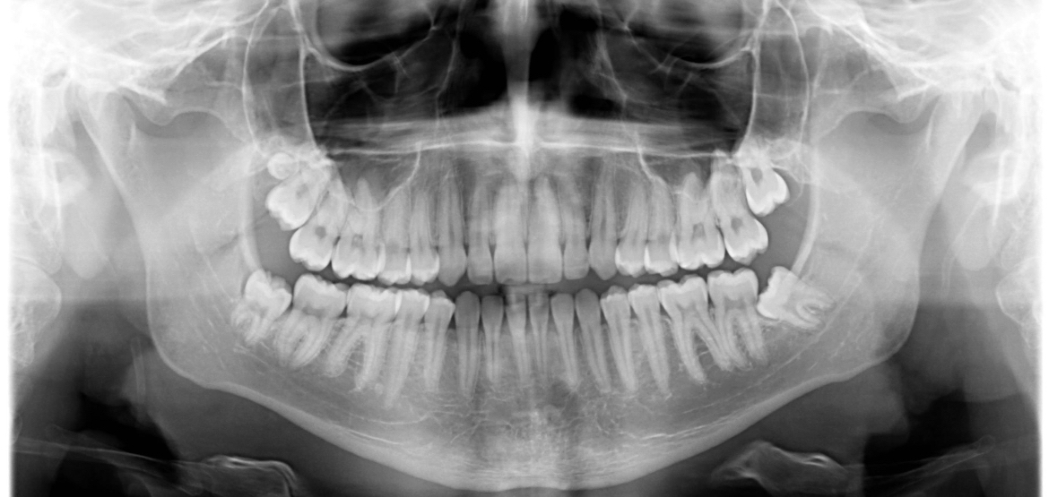 28339A98 F034 4D9E BA59 850F5FC3CEB3